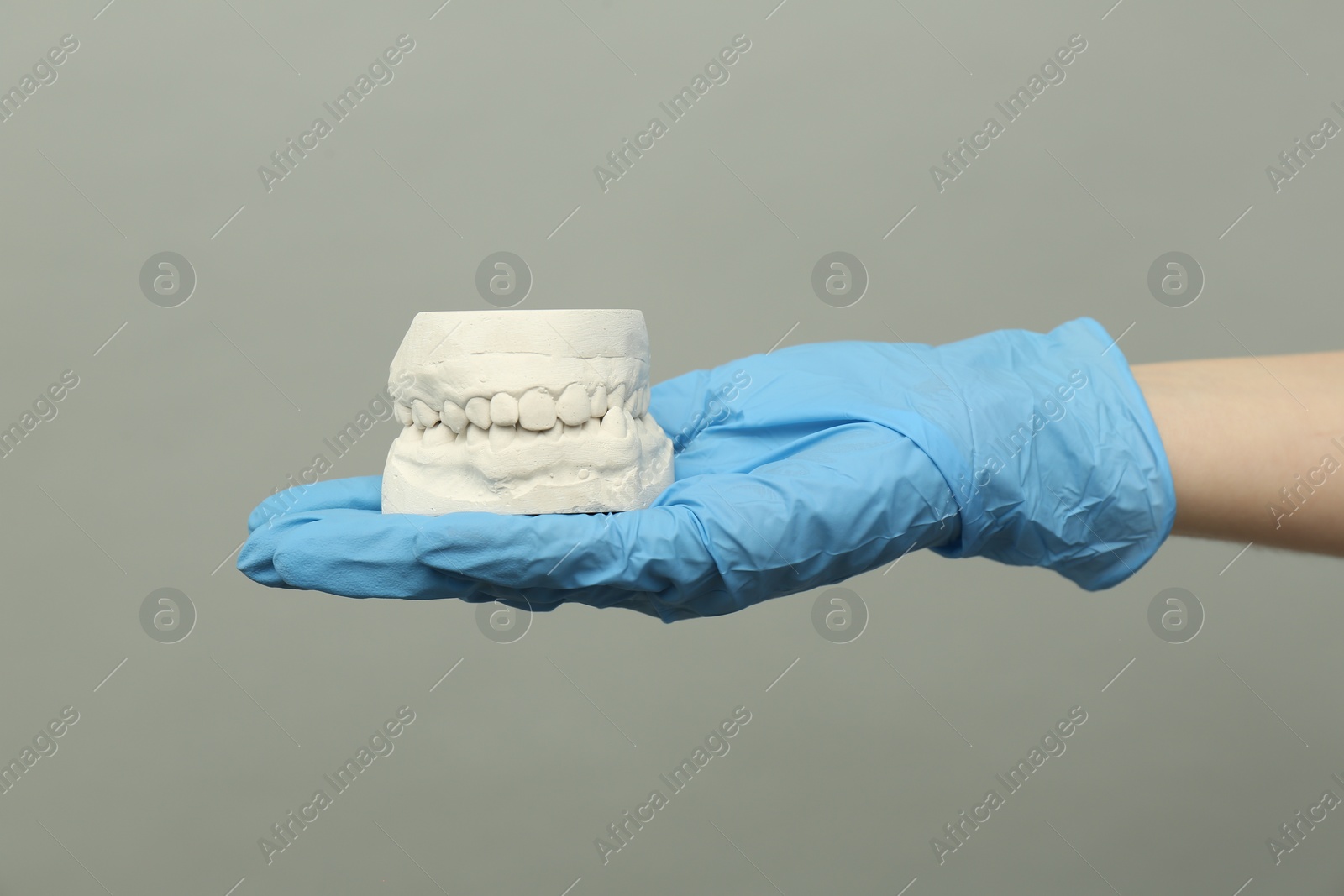 Photo of Doctor holding dental model with jaws on grey background, closeup. Cast of teeth