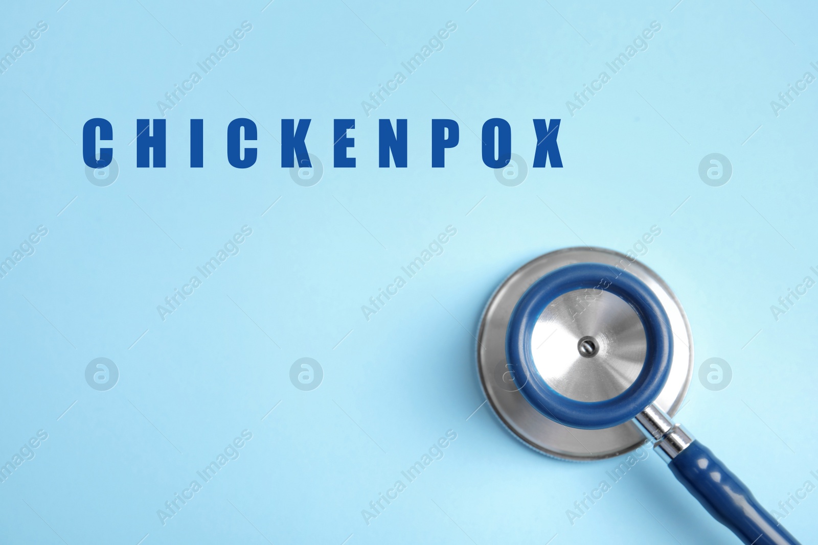 Image of Stethoscope on light blue background, top view. Chickenpox disease 