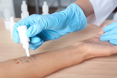 Doctor making allergy test at table, closeup