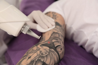 Photo of Young woman undergoing laser tattoo removal procedure in salon, closeup