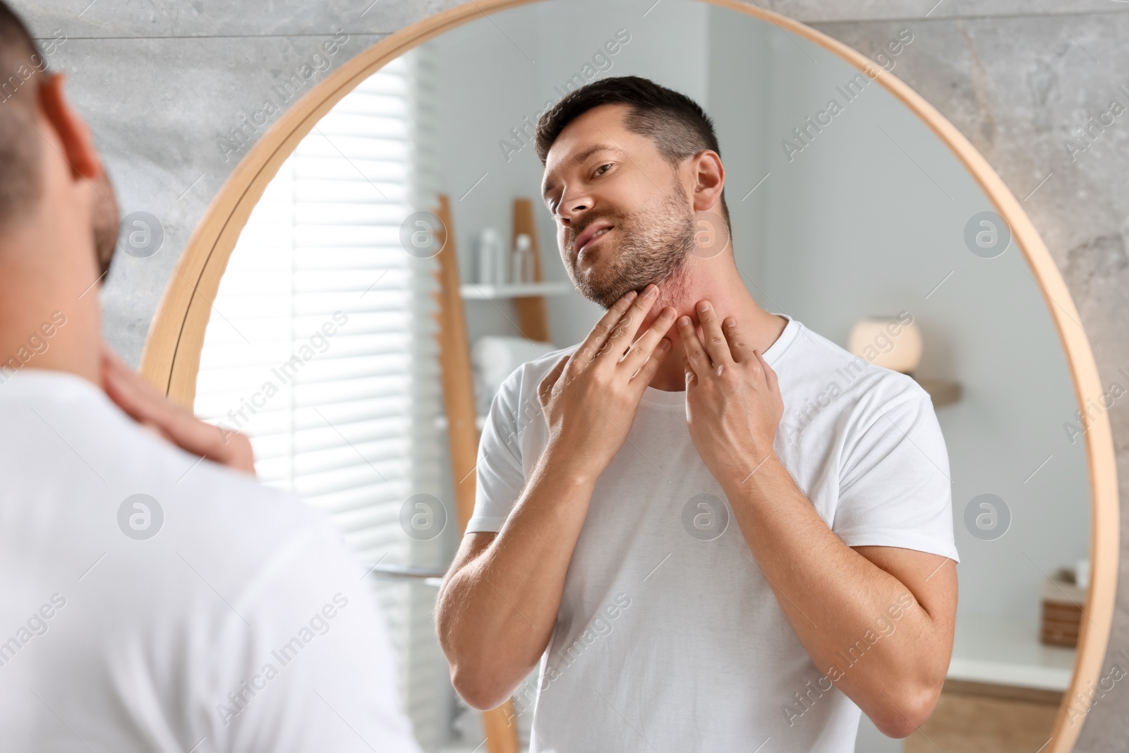 Photo of Man suffering from allergy looking at his neck in mirror indoors