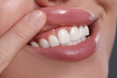 Young woman showing healthy gums, closeup view