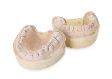 Photo of Dental model with jaws isolated on white. Cast of teeth