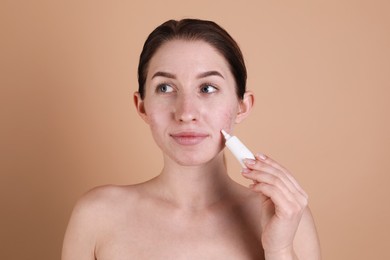 Young woman with acne problem applying cosmetic product onto her skin on beige background