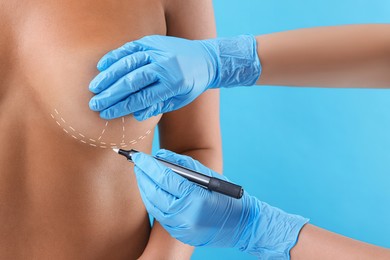 Breast augmentation. Doctor with marker preparing woman for plastic surgery operation against light blue background, closeup