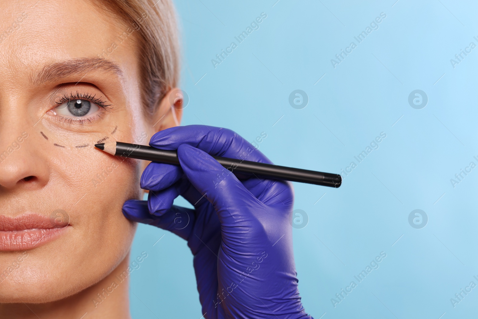 Photo of Doctor with pencil preparing patient for cosmetic surgery operation on light blue background, closeup. Space for text