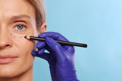 Photo of Doctor with pencil preparing patient for cosmetic surgery operation on light blue background, closeup. Space for text