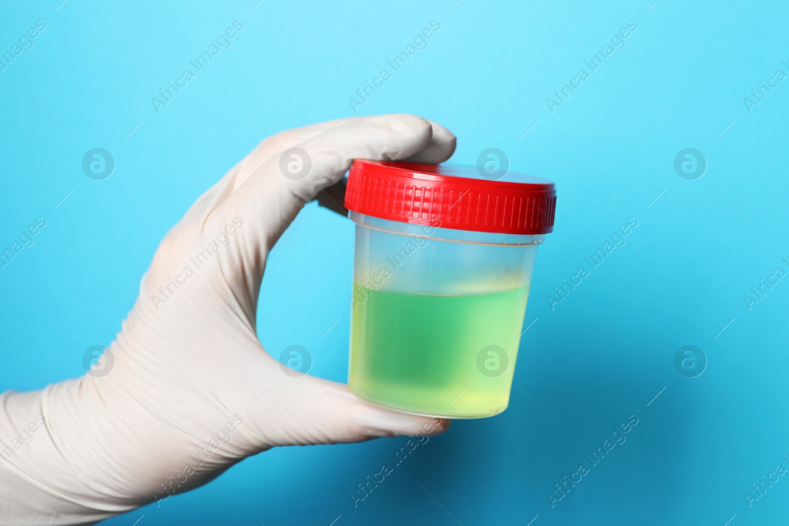 Photo of Doctor wearing glove holding container with urine sample for analysis on light blue background, closeup