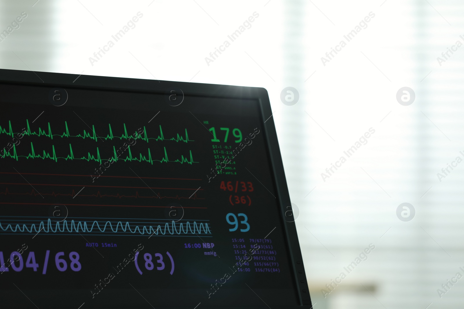 Photo of Monitor with cardiogram in hospital, focus on screen. Space for text