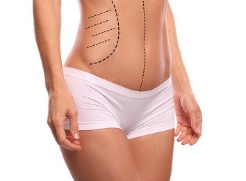 Woman with markings for cosmetic surgery on her abdomen against white background, closeup