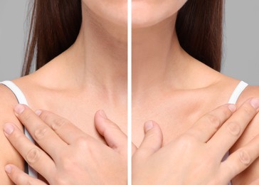 Image of Aging skin changes. Woman showing neck before and after rejuvenation, closeup. Collage comparing skin condition