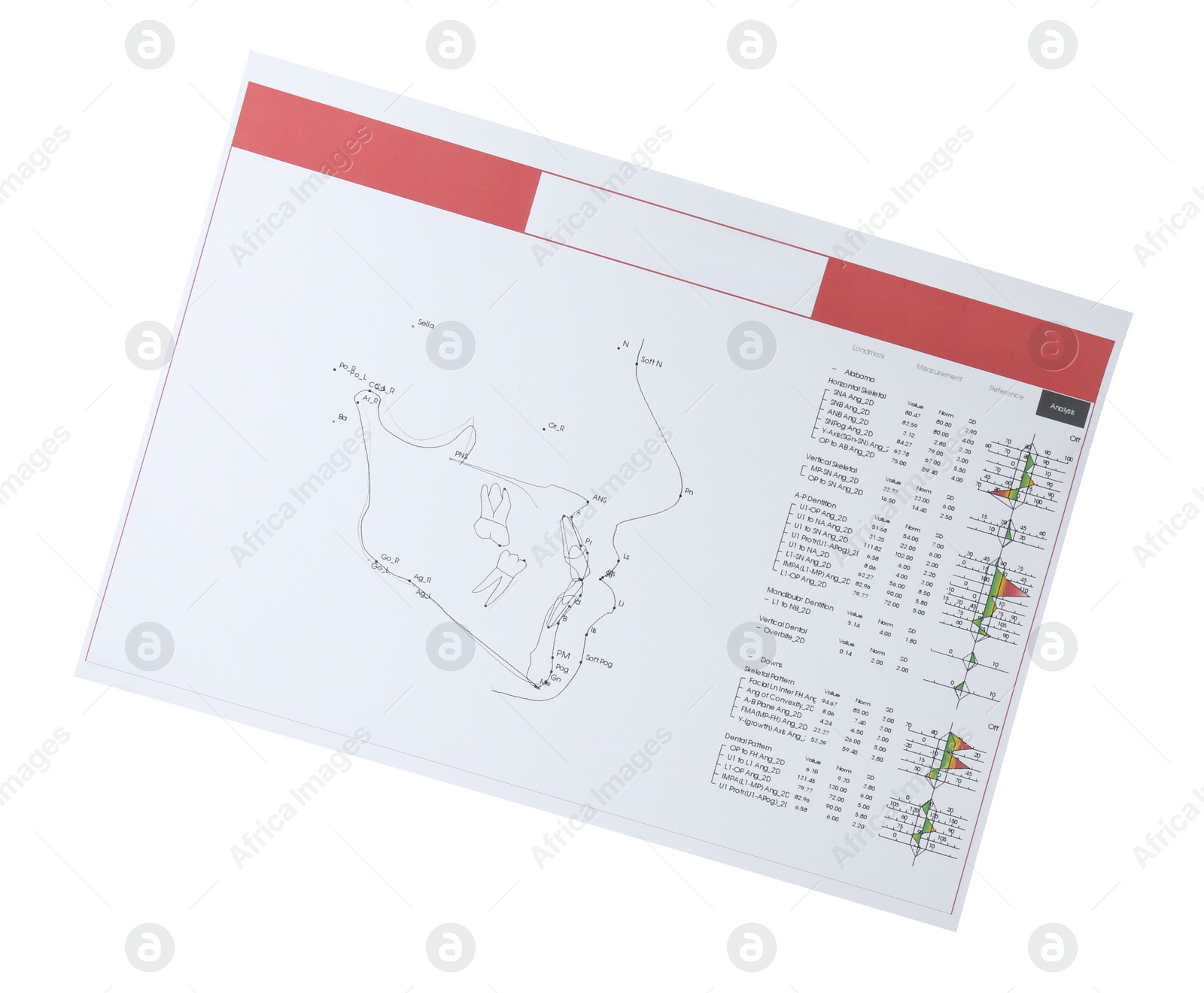 Photo of Visualization of human maxillofacial section for dental analysis printed on paper isolated on white