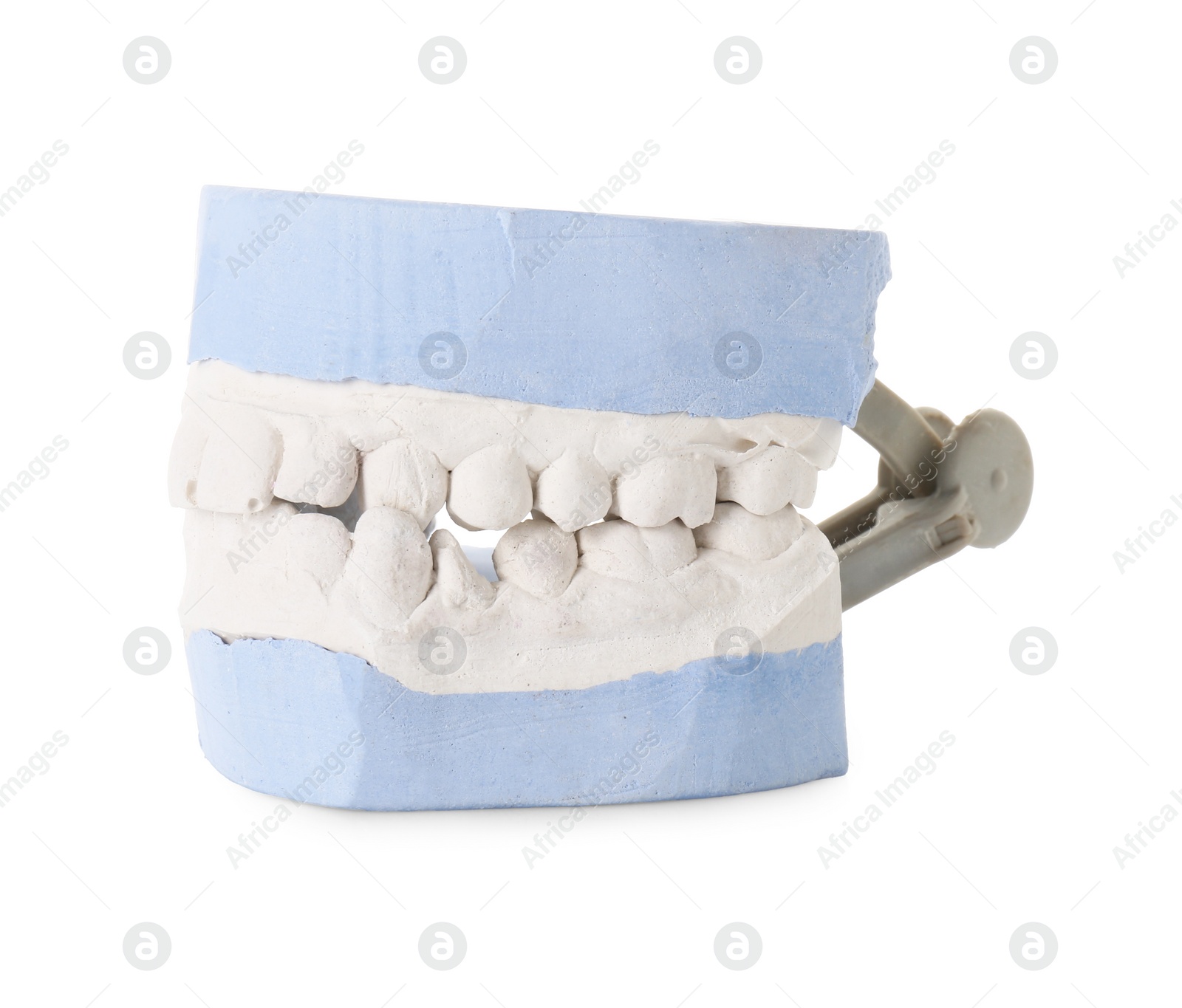 Photo of Dental model with gums isolated on white. Cast of teeth