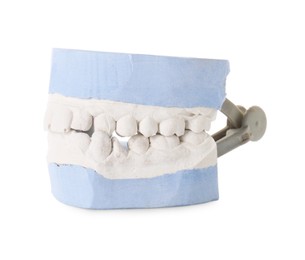 Dental model with gums isolated on white. Cast of teeth