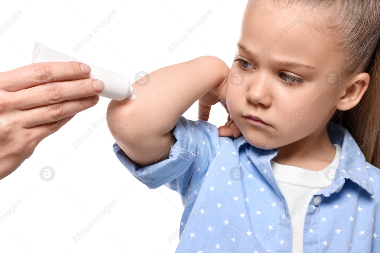 Photo of Mother applying ointment onto her daughter's elbow against white background