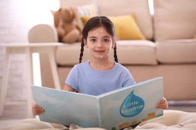 Photo of Little girl with chickenpox reading book at home