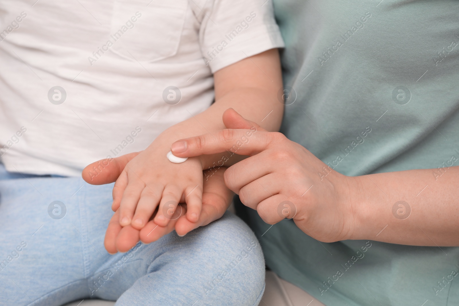 Photo of Mother applying ointment onto her son`s hand, closeup