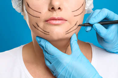 Doctor drawing marks on woman's face for cosmetic surgery operation against blue background, closeup. Double chin problem