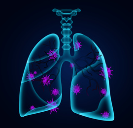 Illustration of  human lungs affected with disease on dark background