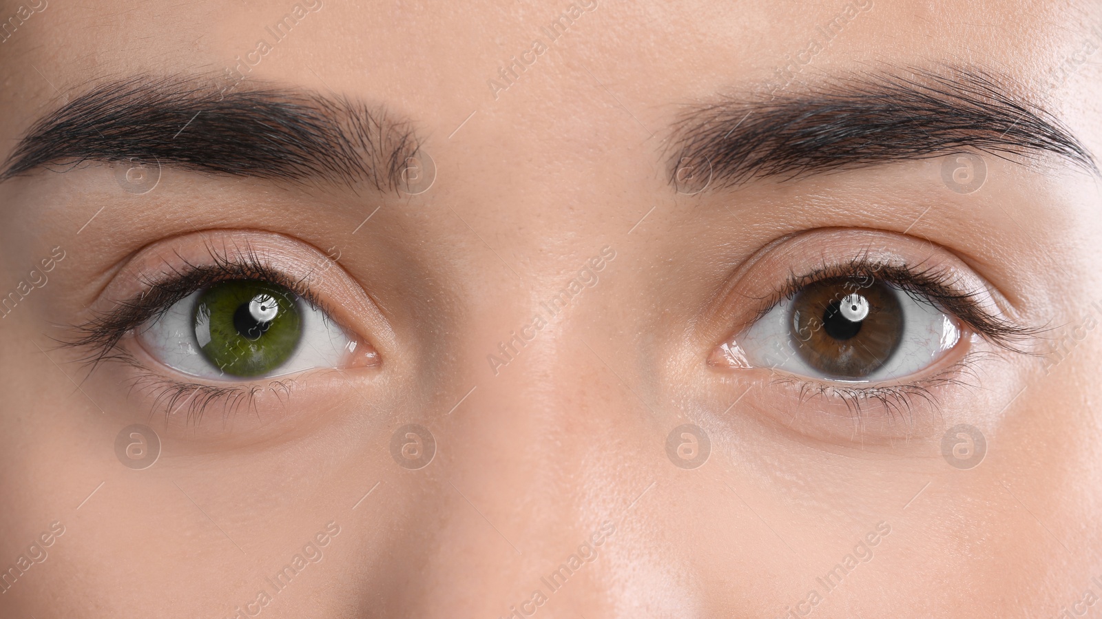 Image of Woman with different colors of eyes, closeup. Heterochromia iridis