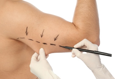 Photo of Doctor drawing marks on man's arm for cosmetic surgery operation against white background, closeup