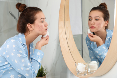 Photo of Teen girl with acne problem cleaning her face near mirror in bathroom