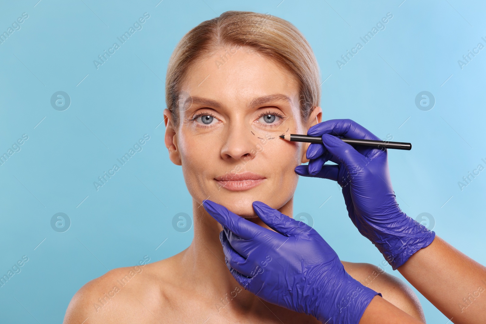 Photo of Doctor with pencil preparing patient for cosmetic surgery operation on light blue background