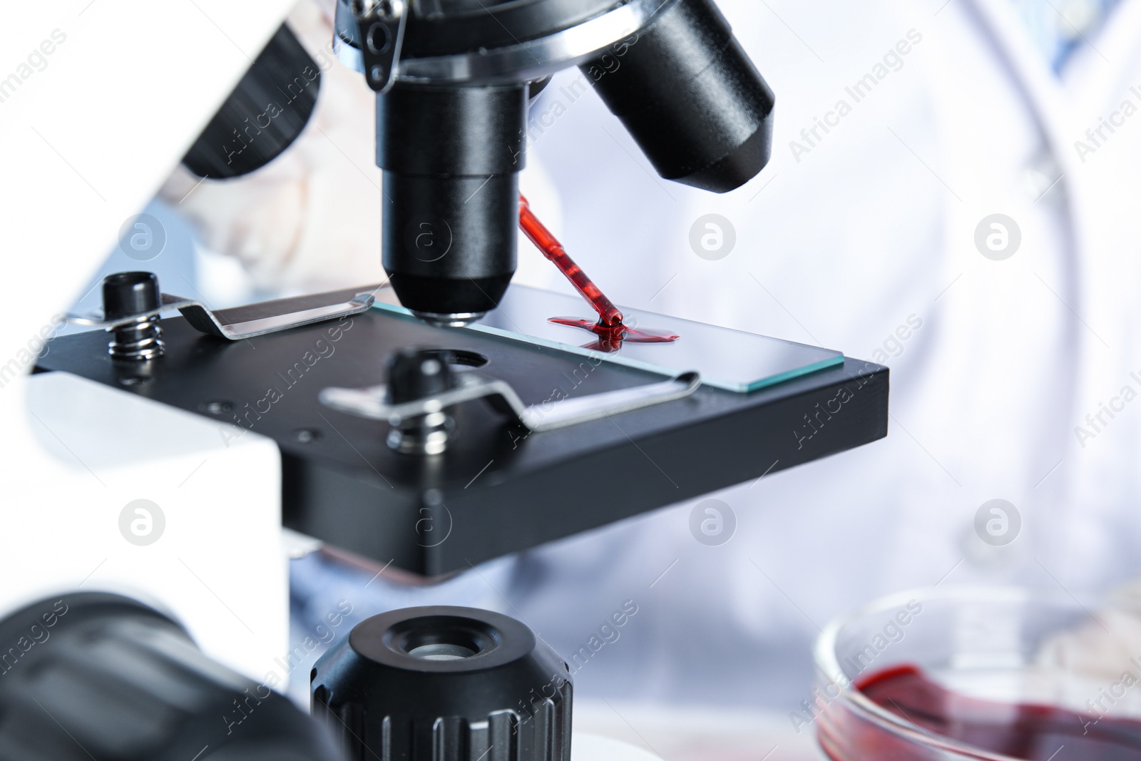 Photo of Scientist dripping blood sample onto slide on microscope in laboratory, closeup. Virus research