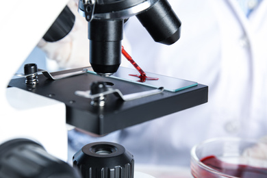 Photo of Scientist dripping blood sample onto slide on microscope in laboratory, closeup. Virus research