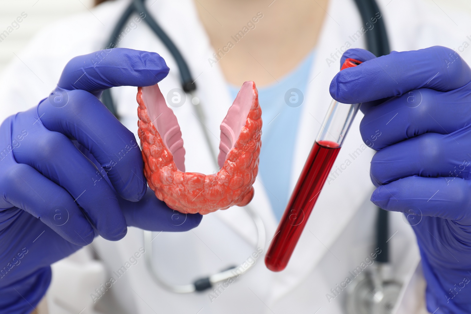 Photo of Endocrinologist showing thyroid gland model and blood sample in test tube, closeup