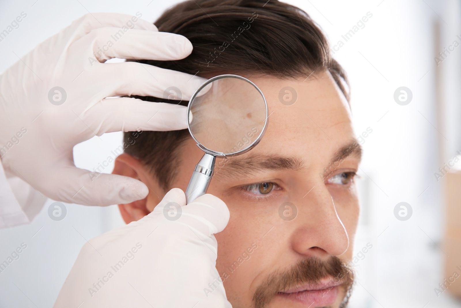 Photo of Dermatologist examining patient's birthmark with magnifying glass in clinic