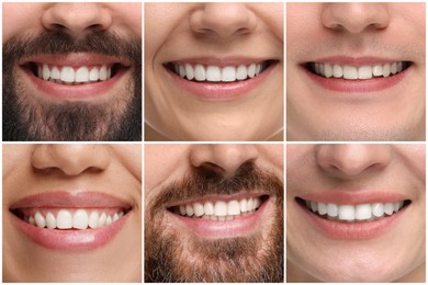 Image of People showing white teeth, closeup. Collage of photos