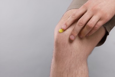 Photo of Man applying yellow ointment onto his knee on light grey background, closeup. Space for text