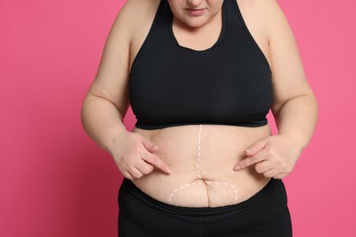 Photo of Obese woman with marks on body against pink background, closeup. Weight loss surgery