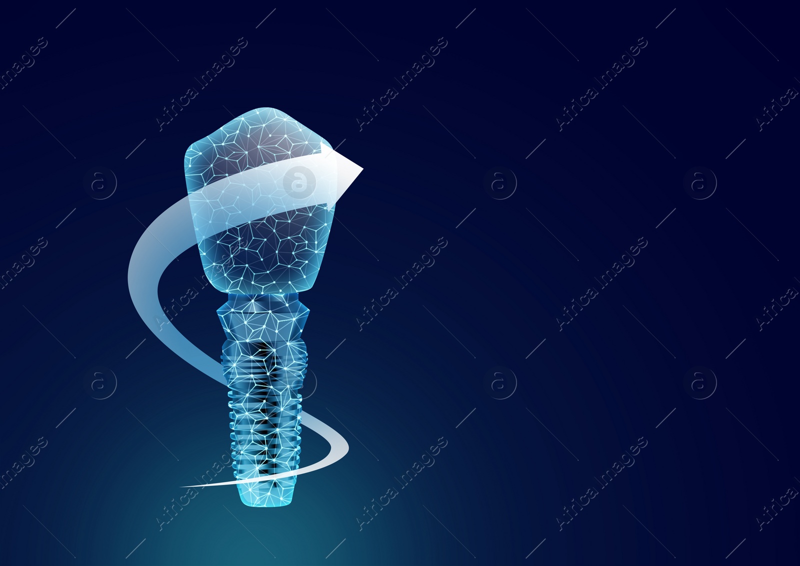 Illustration of  dental implant on dark blue background. Space for text