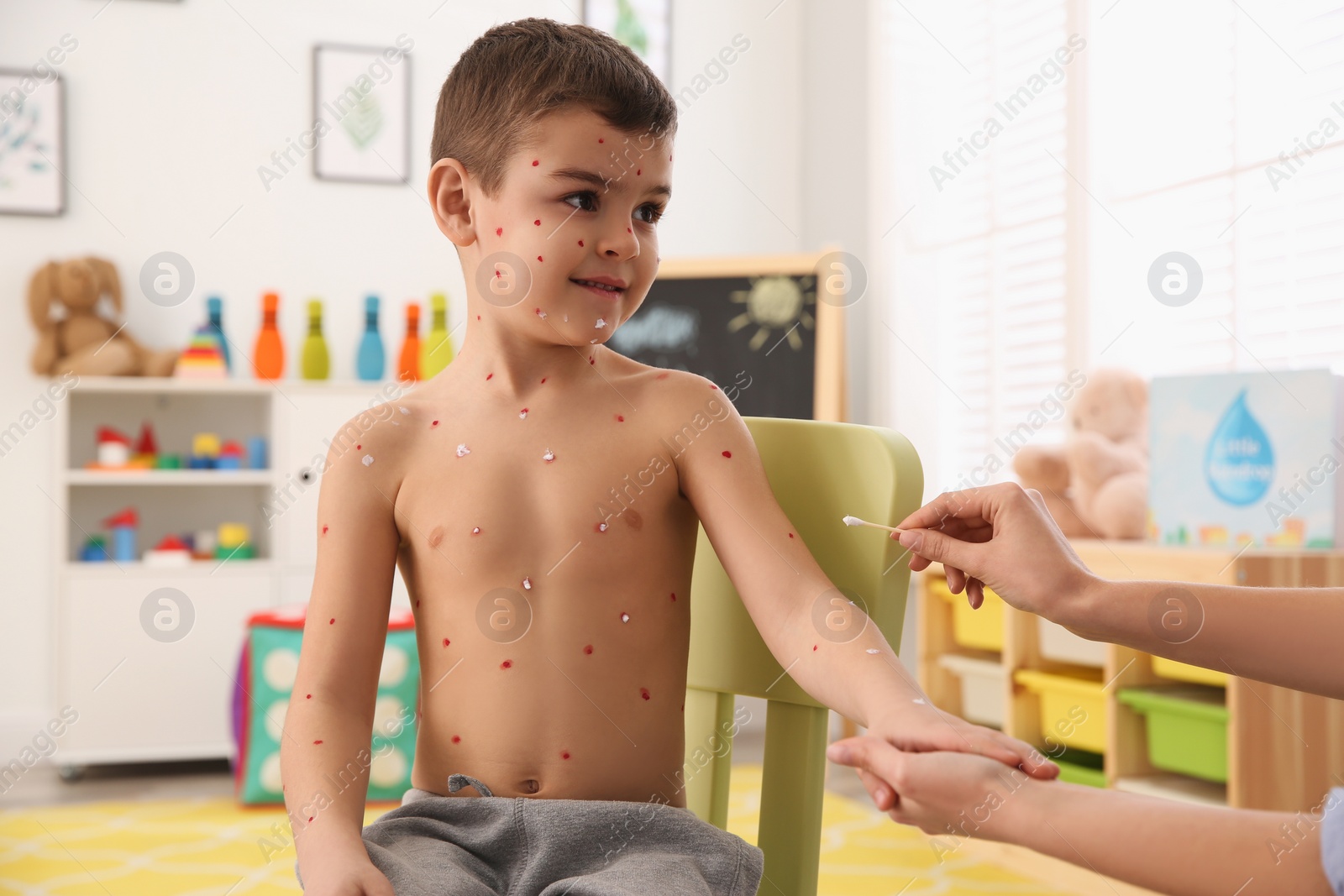 Photo of Woman applying cream onto skin of little boy with chickenpox at home