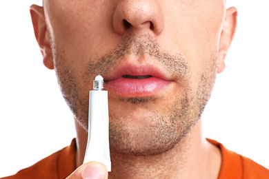 Image of Young man with cold sore applying cream on lips against white background, closeup