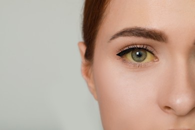 Photo of Closeup view of woman with yellow eyes on light grey background, space for text. Hepatitis symptom