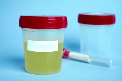 Jar with urine sample on light blue background, space for text