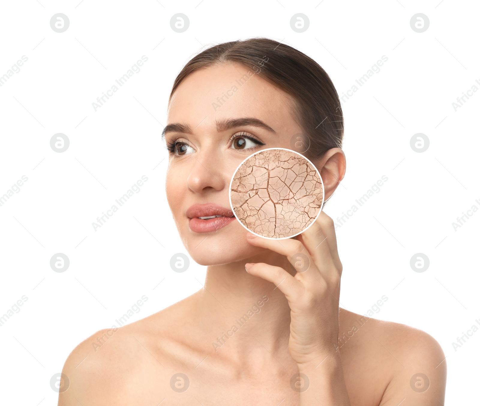 Image of Young woman with facial dry skin problem on white background