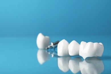 Dental bridge with crowns on light blue background, space for text. Implant parts