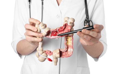 Photo of Doctor showing model of large intestine on white background, closeup