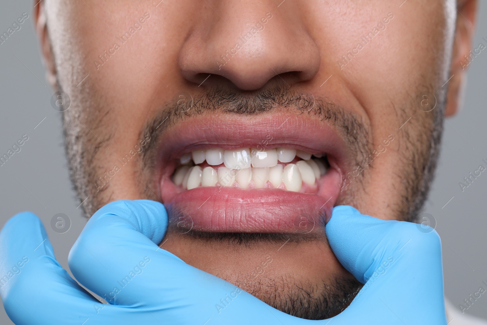 Photo of Dentist examining man's gums on grey background, closeup