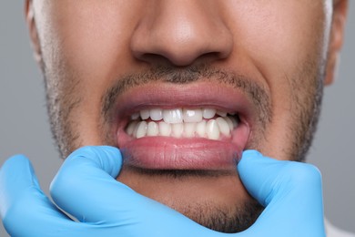 Dentist examining man's gums on grey background, closeup