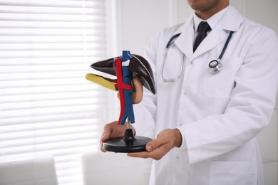 Doctor demonstrating model of liver in clinic, closeup