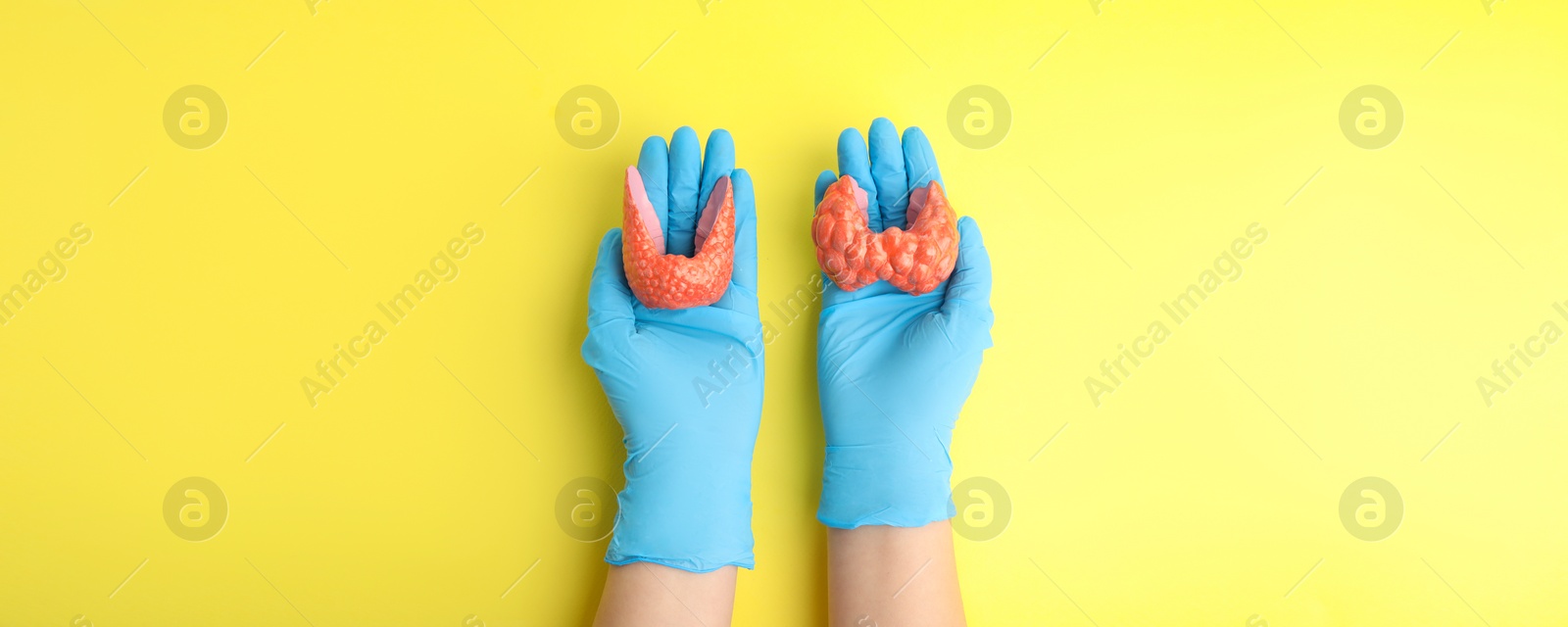 Image of Endocrinologist holding thyroid gland models on yellow background, top view. Banner design