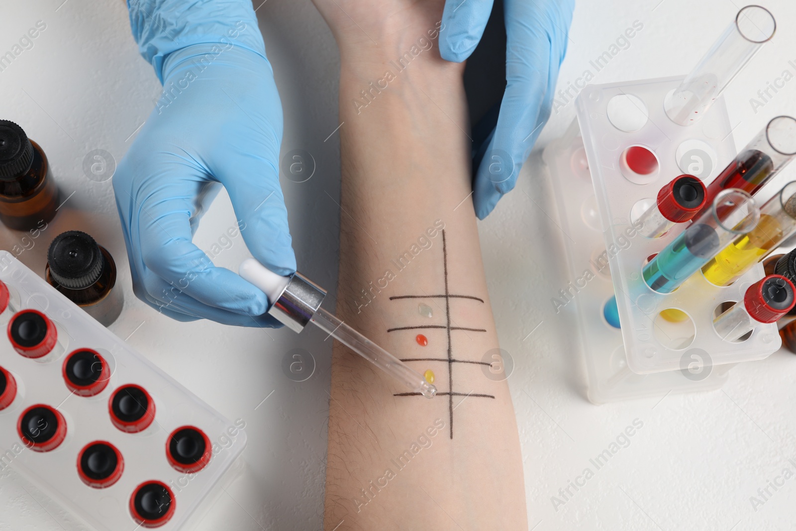 Photo of Doctor doing skin allergy test at light table, top view