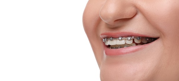 Smiling woman with braces on white background, closeup. Banner design with space for text