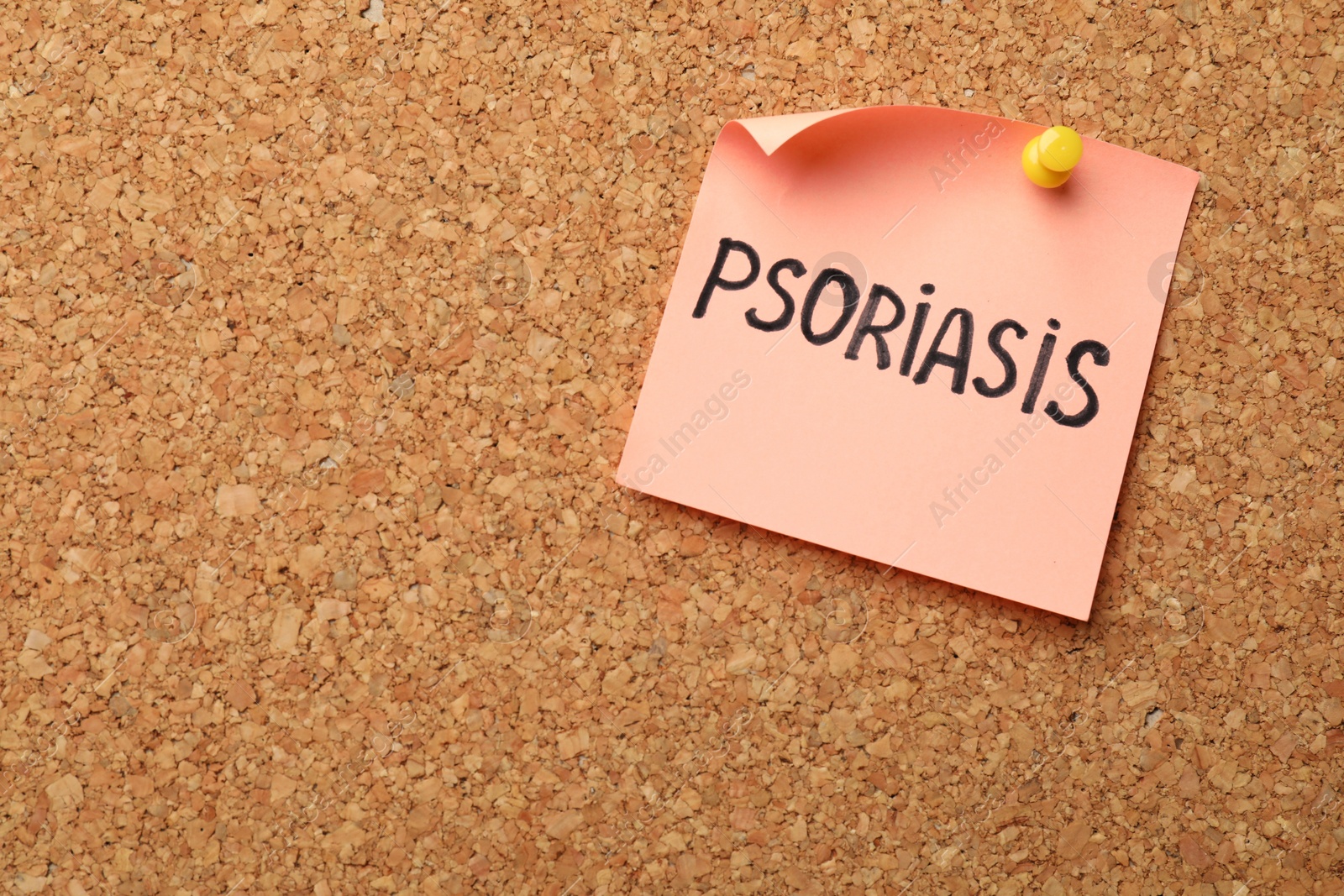 Photo of Paper note with word Psoriasis pinned on cork board