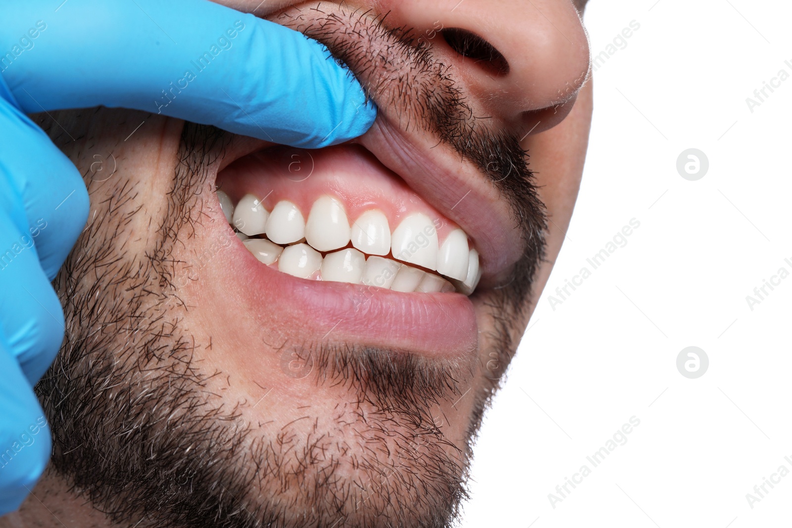 Photo of Man showing healthy gums on white background, closeup